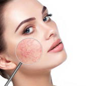 Sensitive Skin (14)