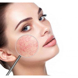 Sensitive Skin