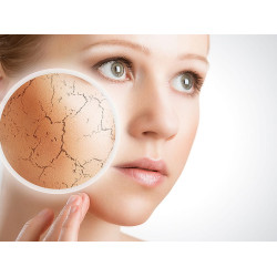 Dry Skin