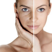 Hyperpigmented Skin (9)