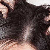 Sebum Control & Dandruff (3)