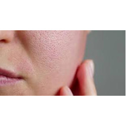 Enlarged Pores