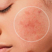 For Sensitive Skin (0)